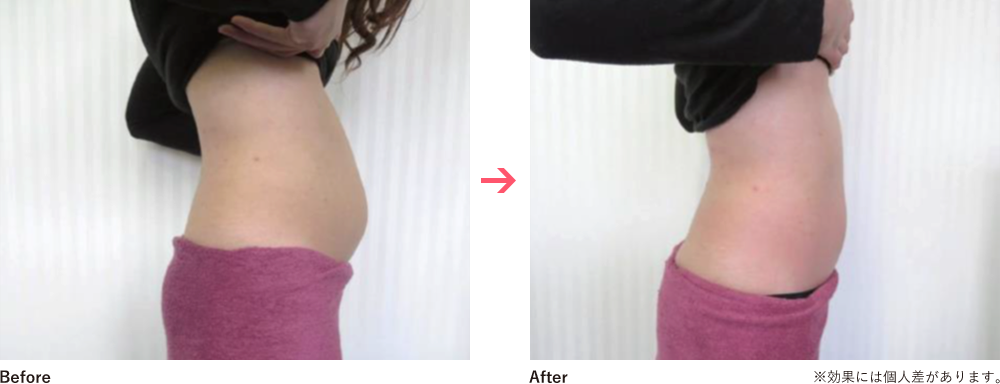 Before&After