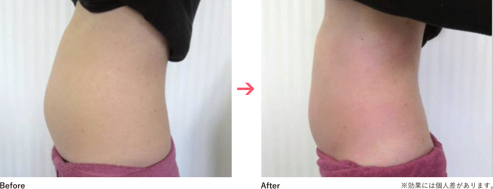 Before&After