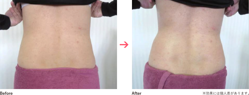 Before&After